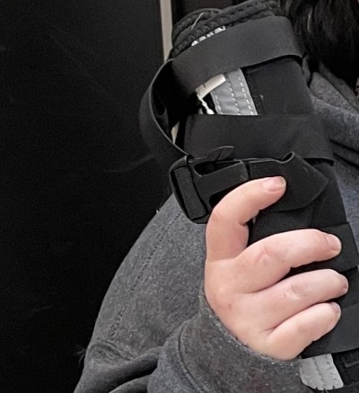 Hinged Dog Leg Brace review 