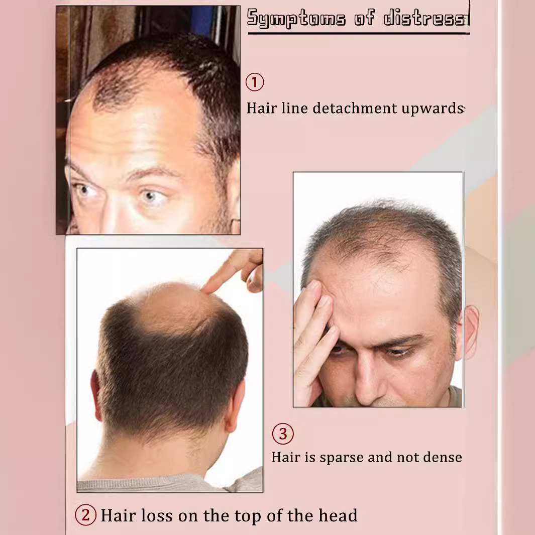 Men's Wig Handsome Big Back Hair Replacement Piece