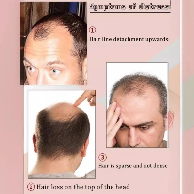 Men's Wig Handsome Big Back Hair Replacement Piece 02